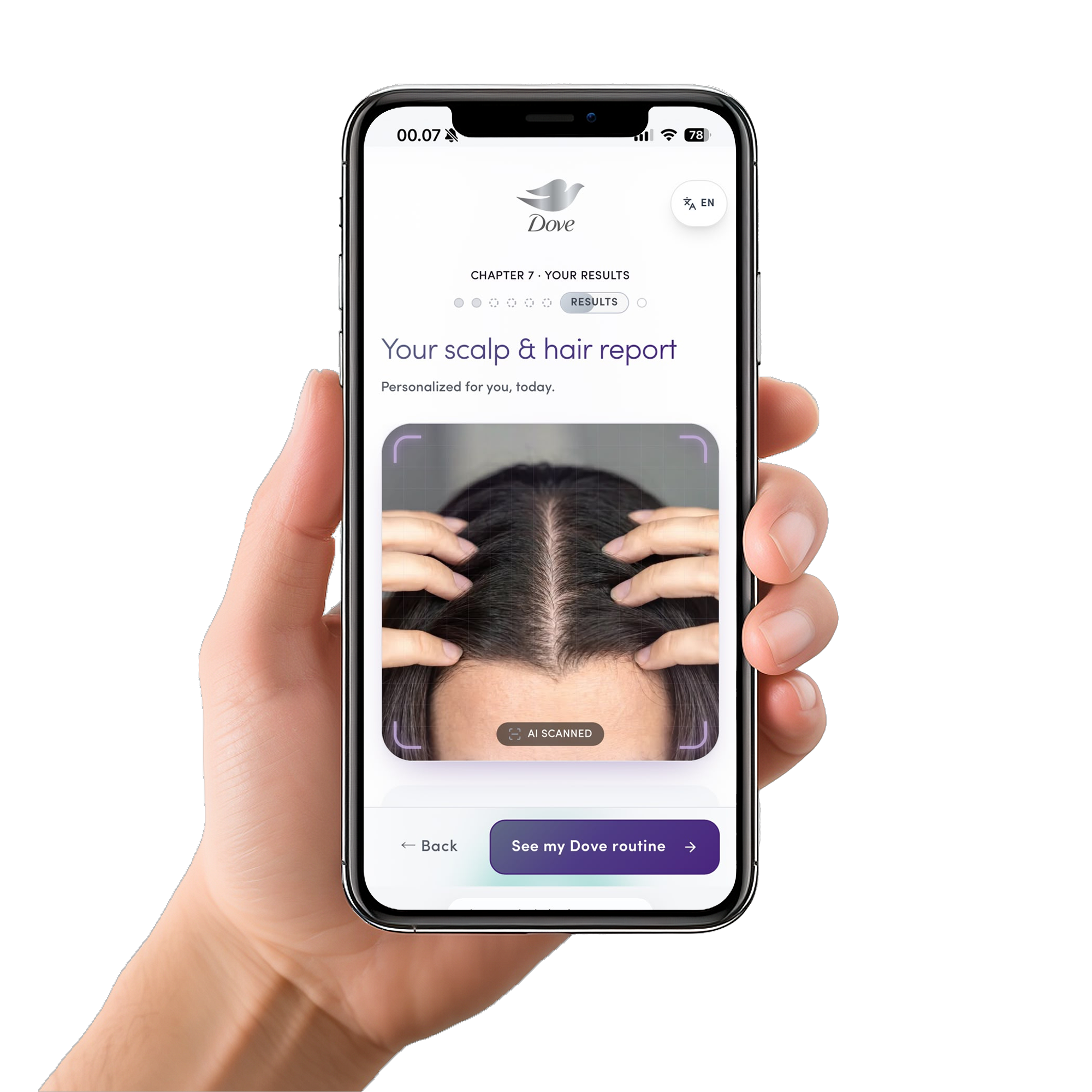 dove scalp ai checker