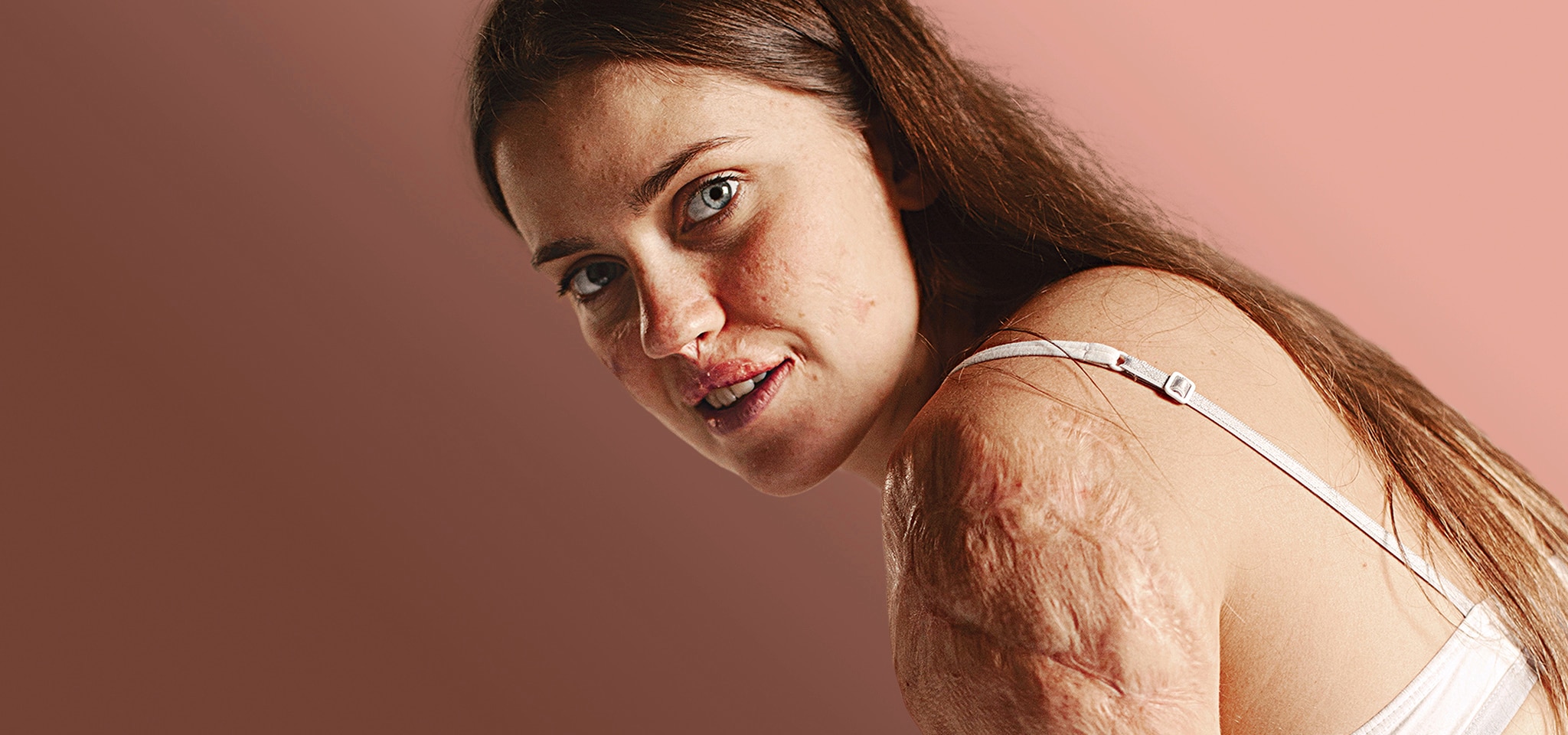 Resilience | Dove ChangeIsBeautiful ​