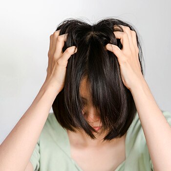 Ketombe karena Stress