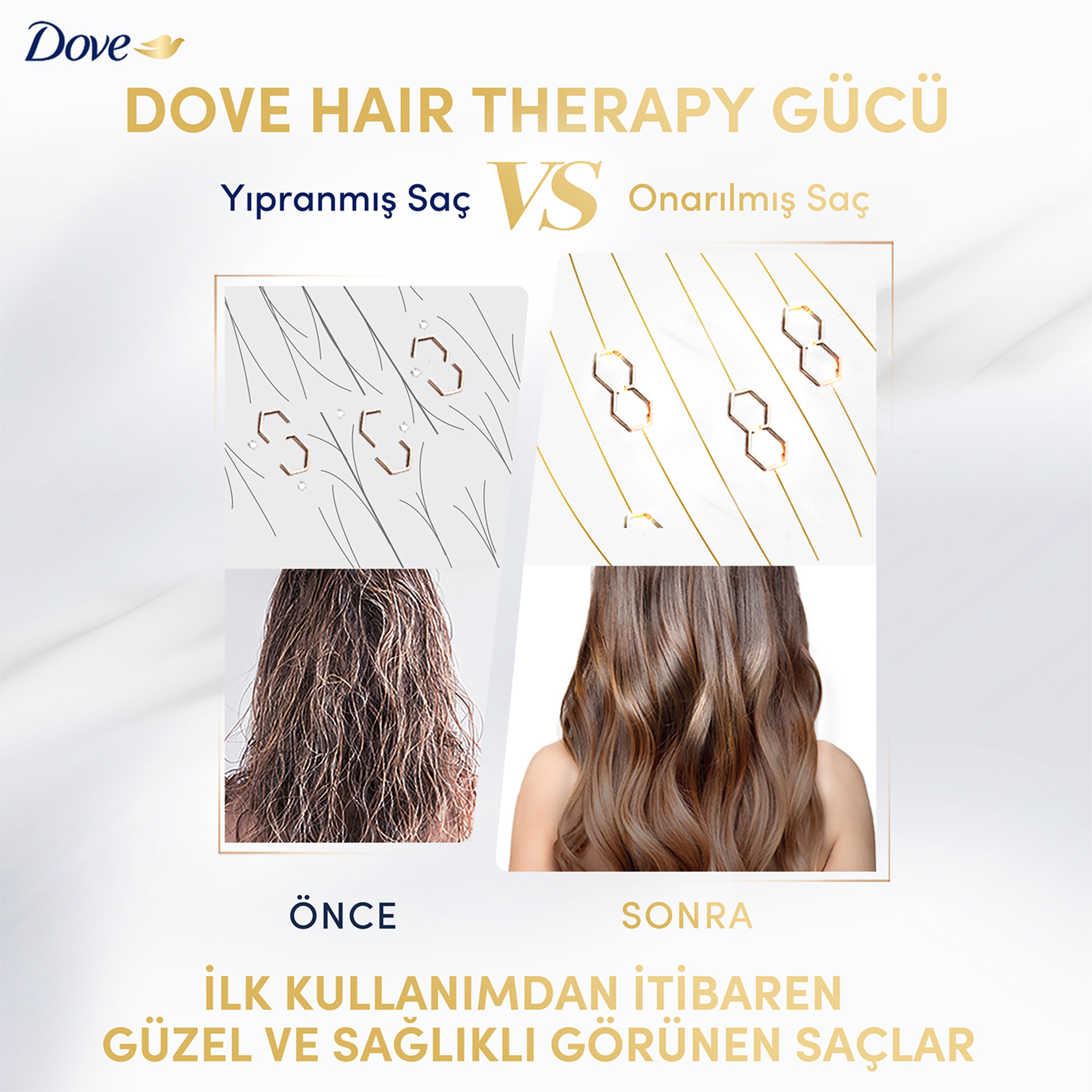 Dove Hair Therapy Breakage Remedy Sülfatsız Serum Saç Bakım Kremi