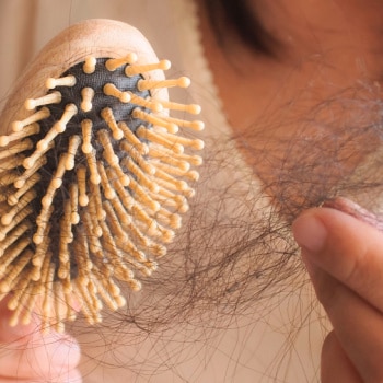 Cara Mengatasi Rambut Rontok Berlebihan