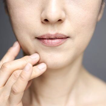 kulit kering dan kusam