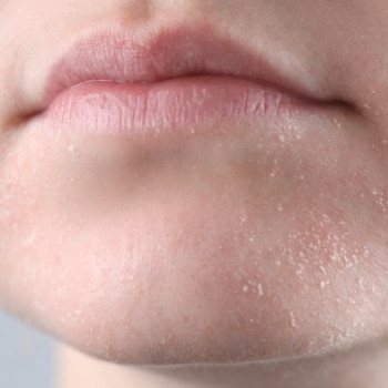 skincare untuk kulit kering