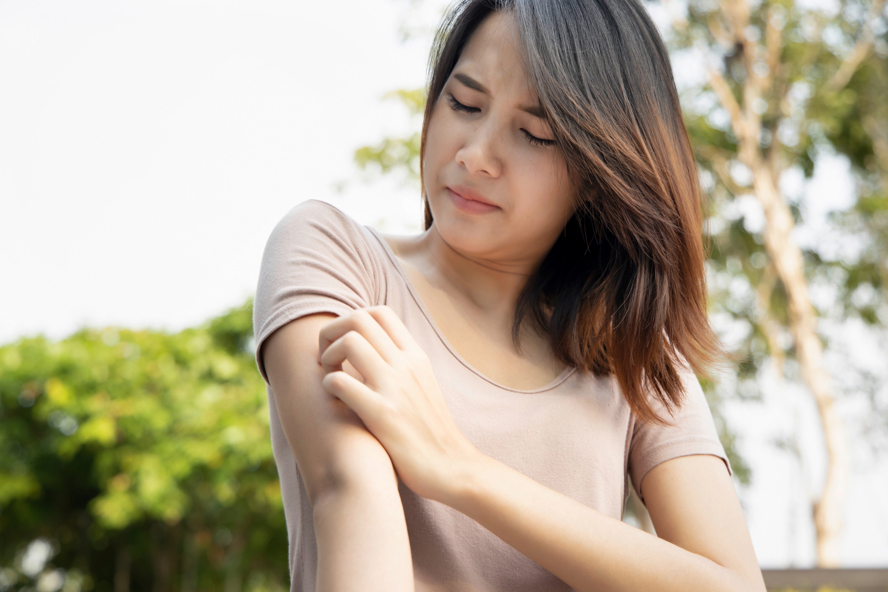 Woman scratching her arm outdoors