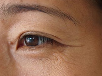 7 Cara Menghilangkan Keriput dan Kerutan Di Wajah Secara Alami