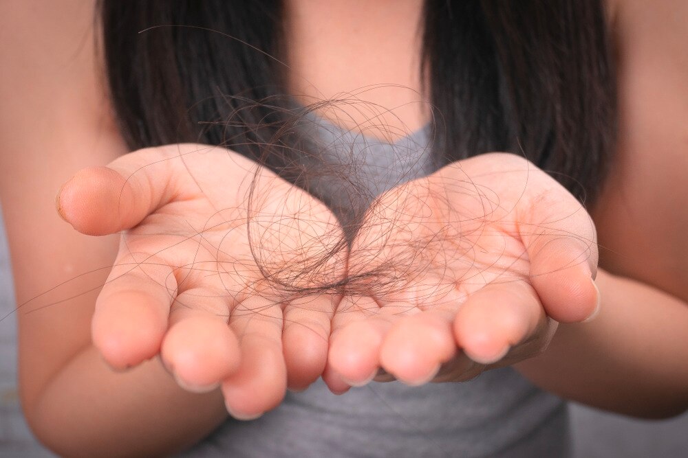 Closeup of a woman’s hands showing fallen hair strands.