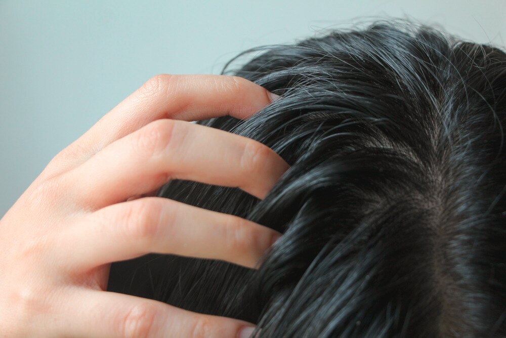 Woman with oily black hair scratching her scalp.