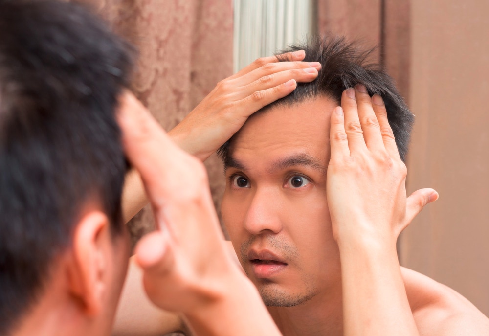 Asian man looking at scalp in mirror.