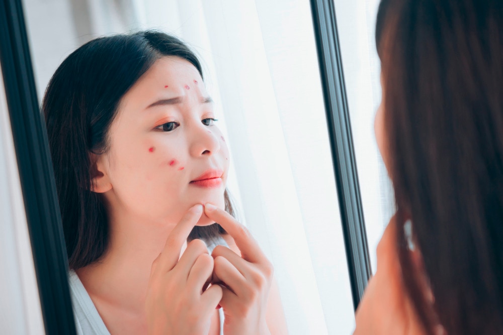 Woman trying to pop her pimple in front of the mirror.