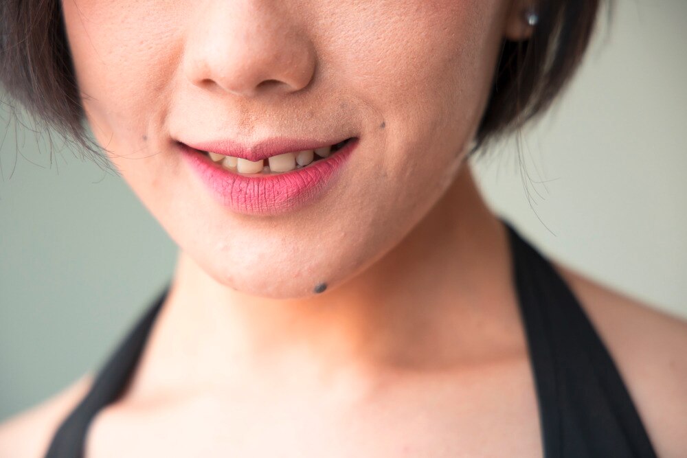 A close-up photo of smiling woman with tooth gap.