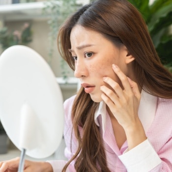 cara menghilangkan dark spot