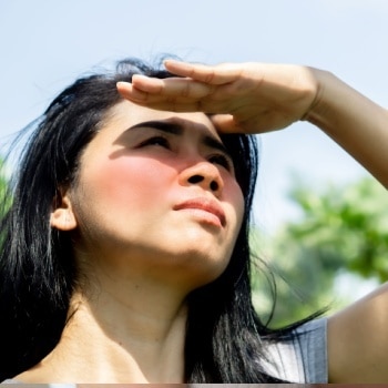14 Cara Mengatasi Kulit Terbakar Matahari atau Sunburn Secara Alami