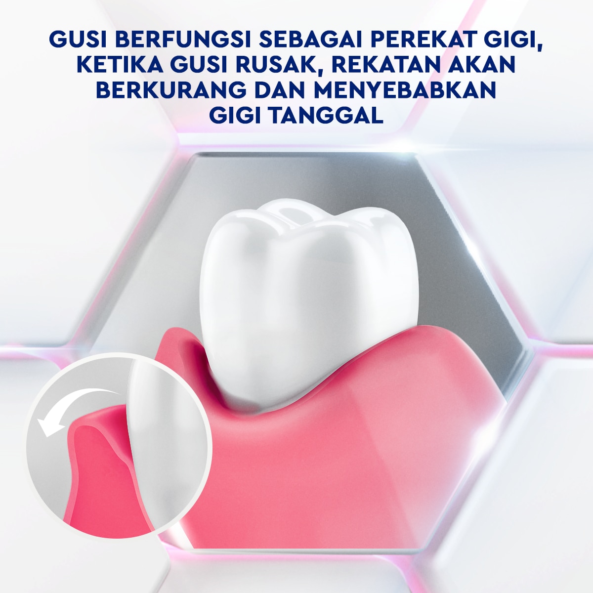 Pasta Gigi Pepsodent Gum Expert Fresh