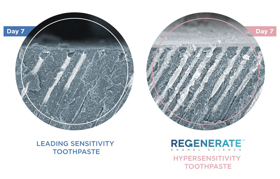 superior-tubule-penetration