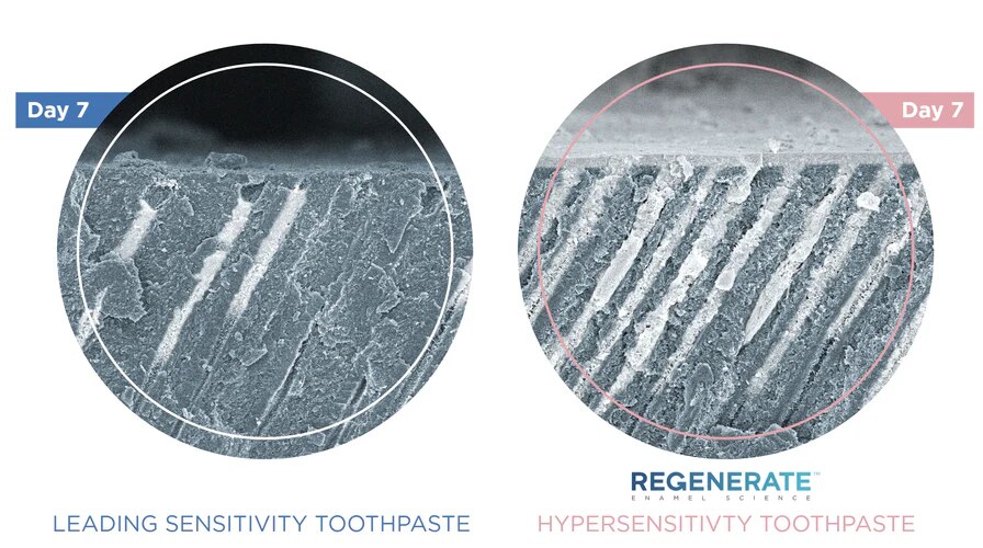 A BREAKTHROUGH TREATMENT FOR HYPERSENSITIVITY