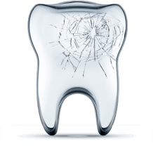 Comment soigner une carie?