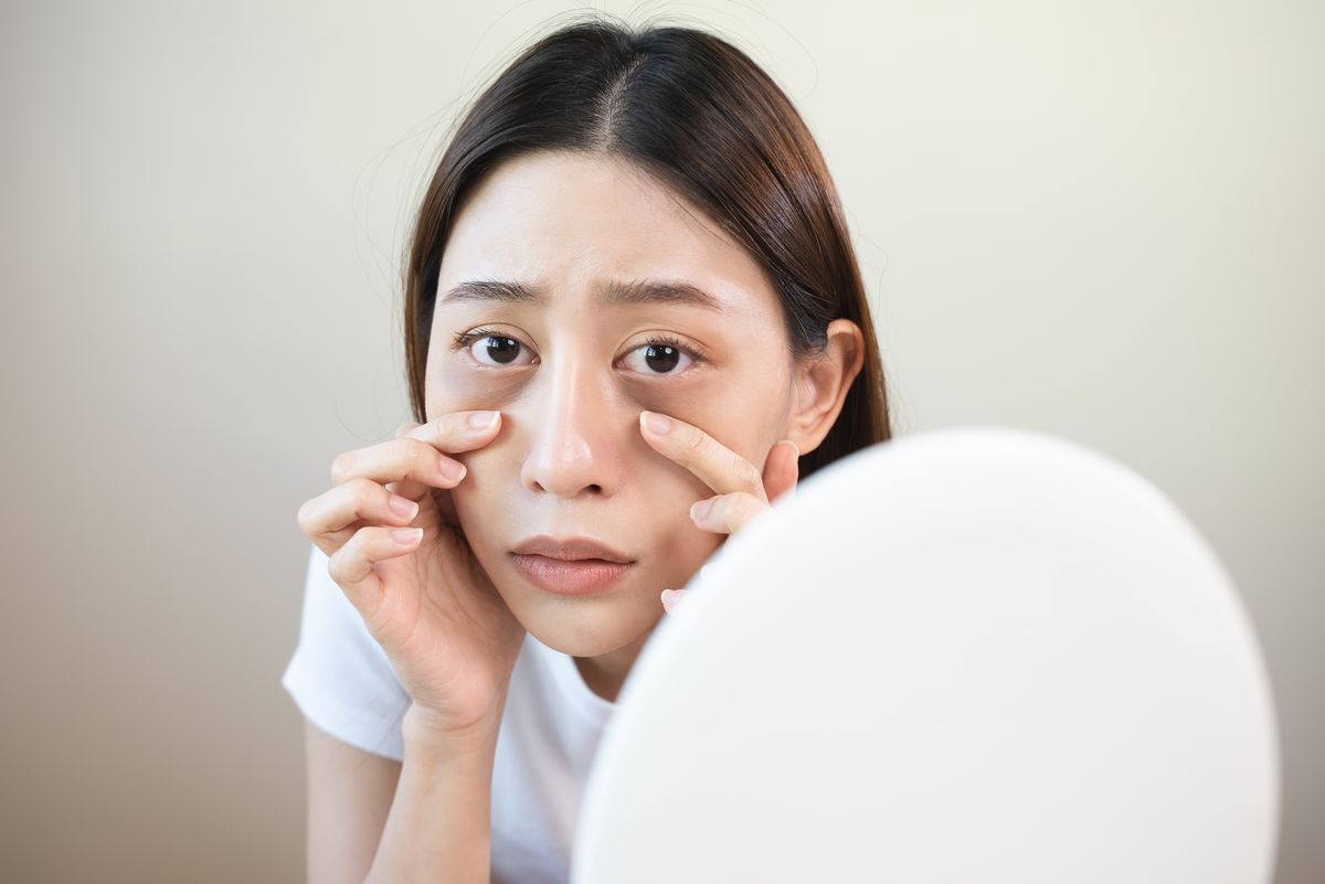 Woman touching her dark circles in front of a mirror.