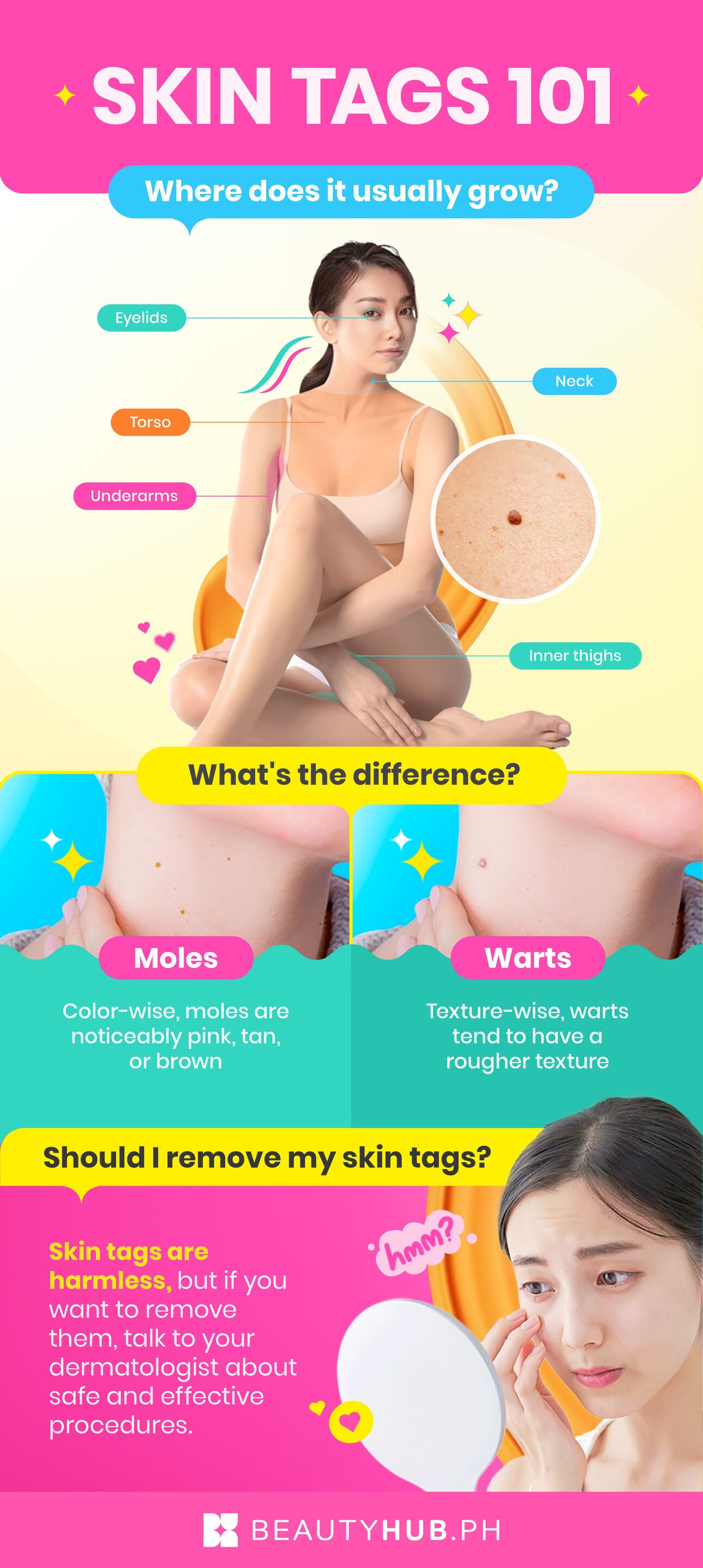 Infographic featuring a woman with skin tags
