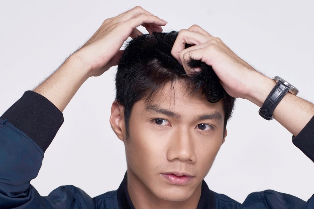 How to Remove Dandruff Based on What's Causing It