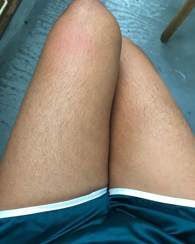 A picture of a woman’s hairy thighs.