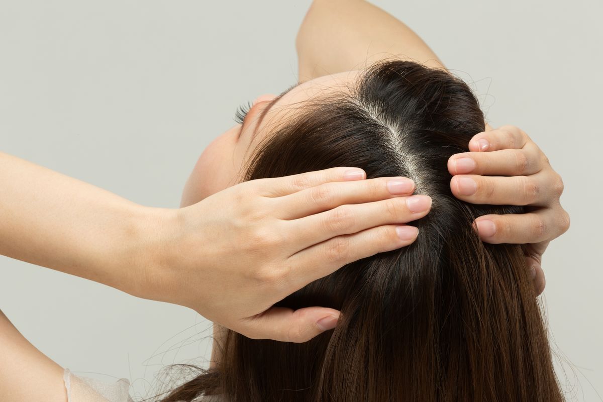 Woman showing her scalp and long hair.  