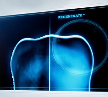 Cómo reforzar los dientes y el esmalte 