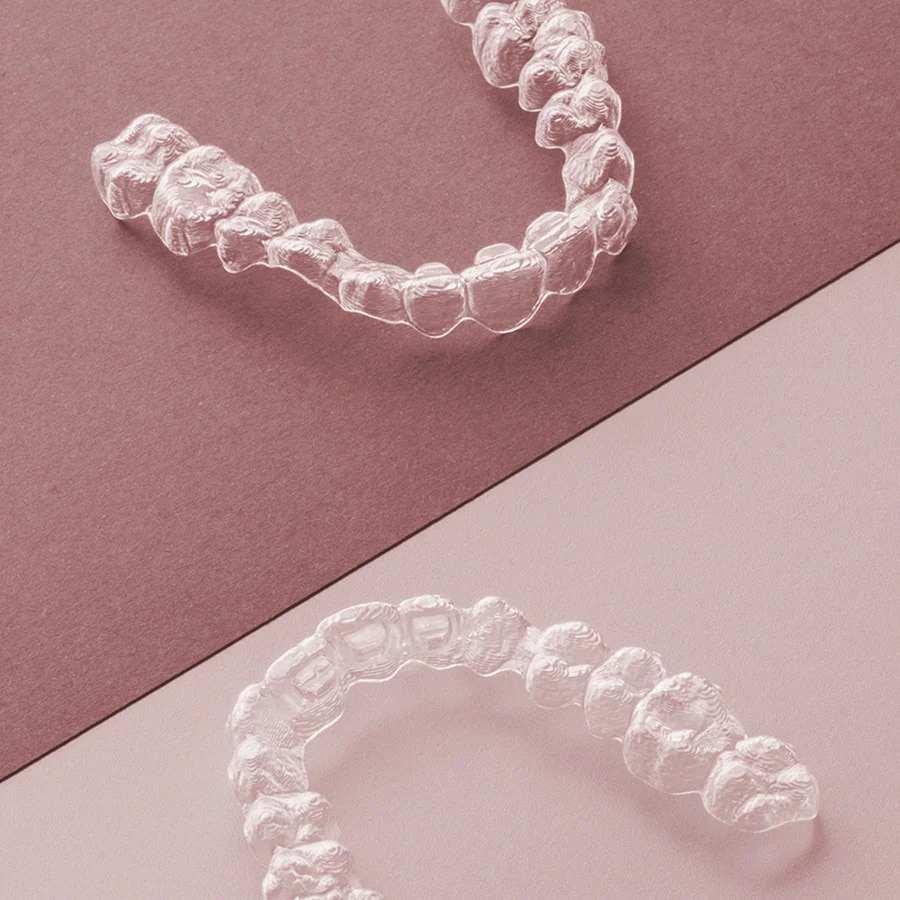 Sensitive teeth from braces and retainer pain: causes and prevention