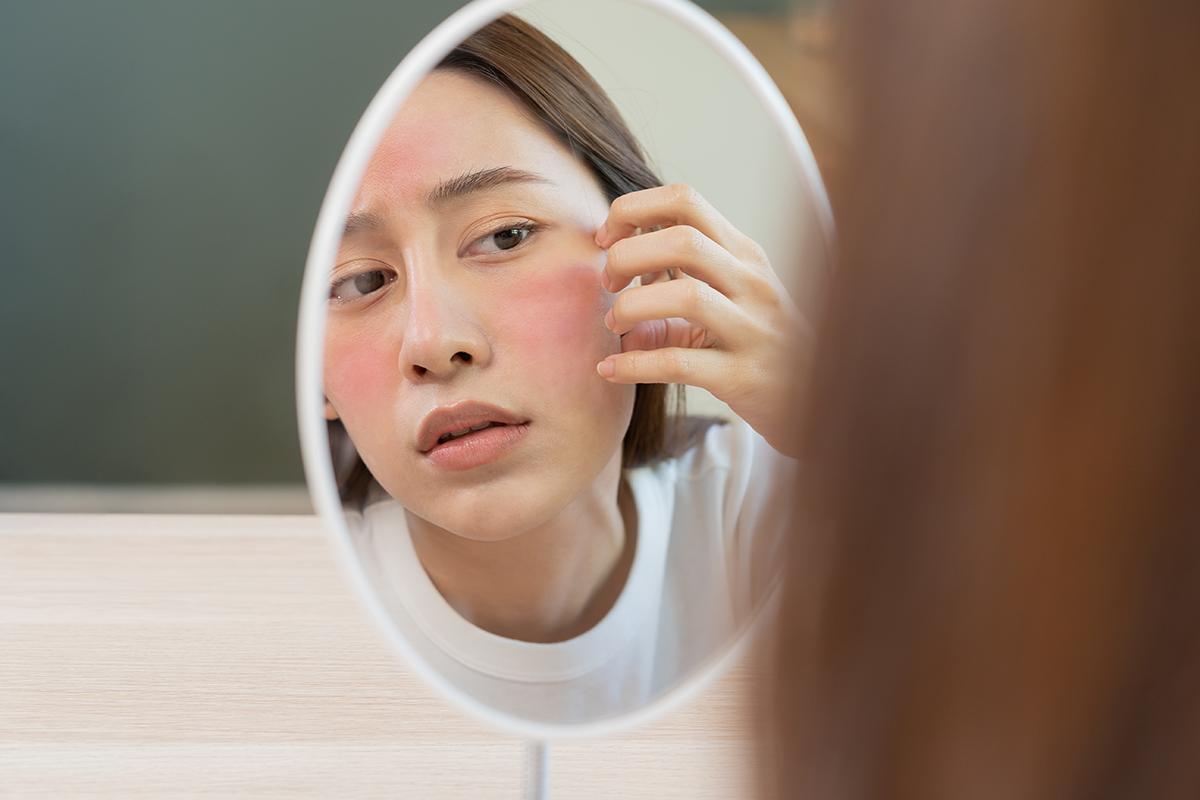 Asian woman with facial redness looking at the mirror