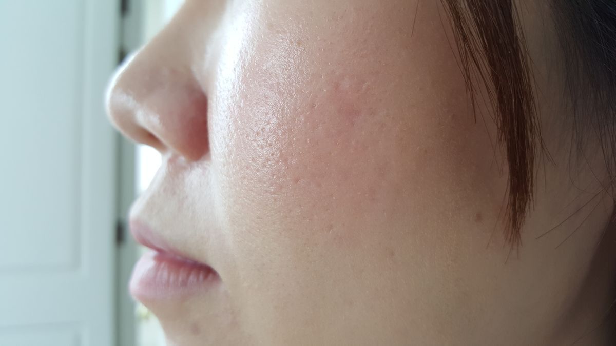 Closeup of a woman’s pores