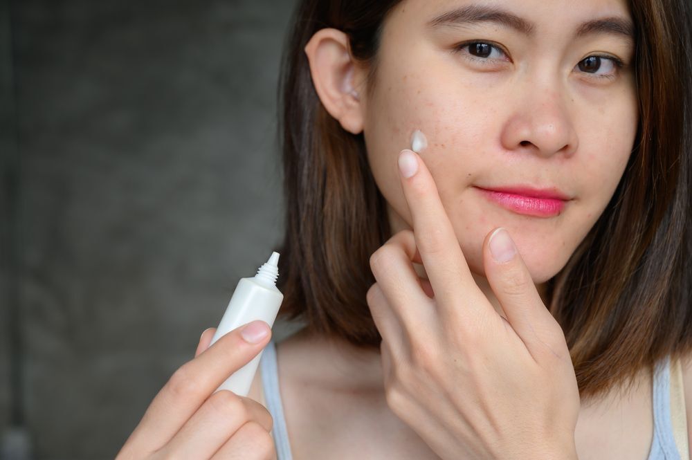 How to Treat Cystic Acne, According to a Skin Expert