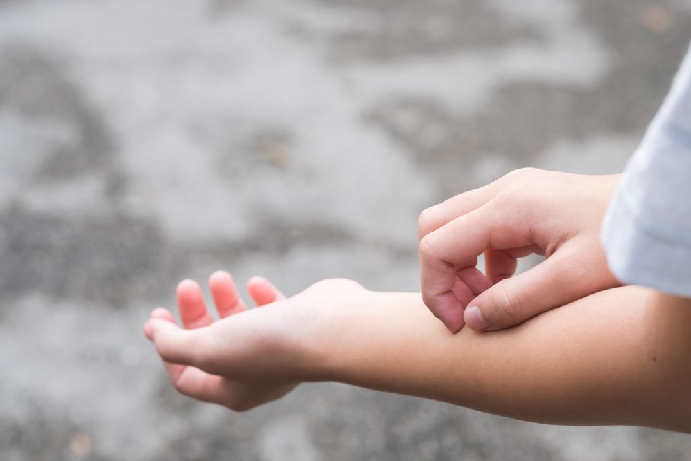 Woman scratching an insect bite on her arm.