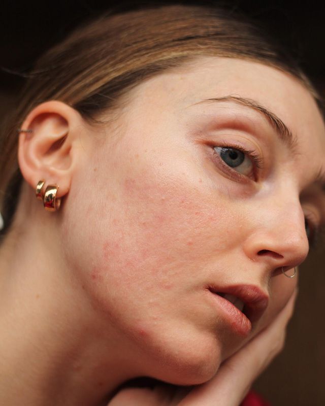 Woman posing for a profile shot with a bare face.
