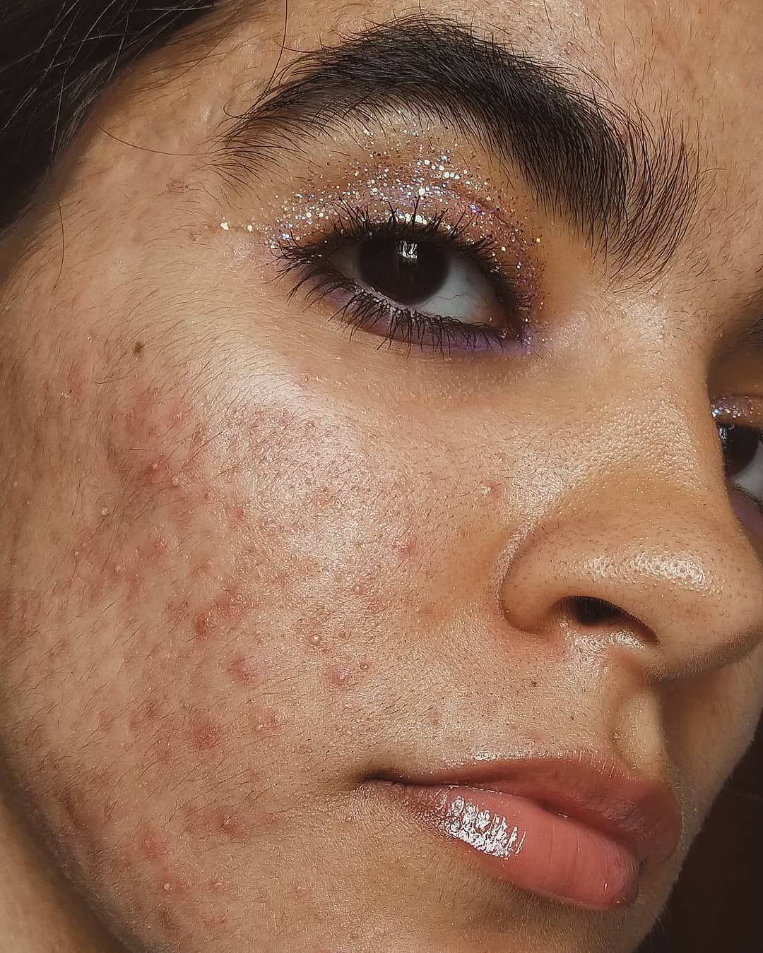 Constanza Concha, a skin-positivity influencer, posed on the cover of Glamour magazine. (Crediit: instagram/skiinnoshame) 