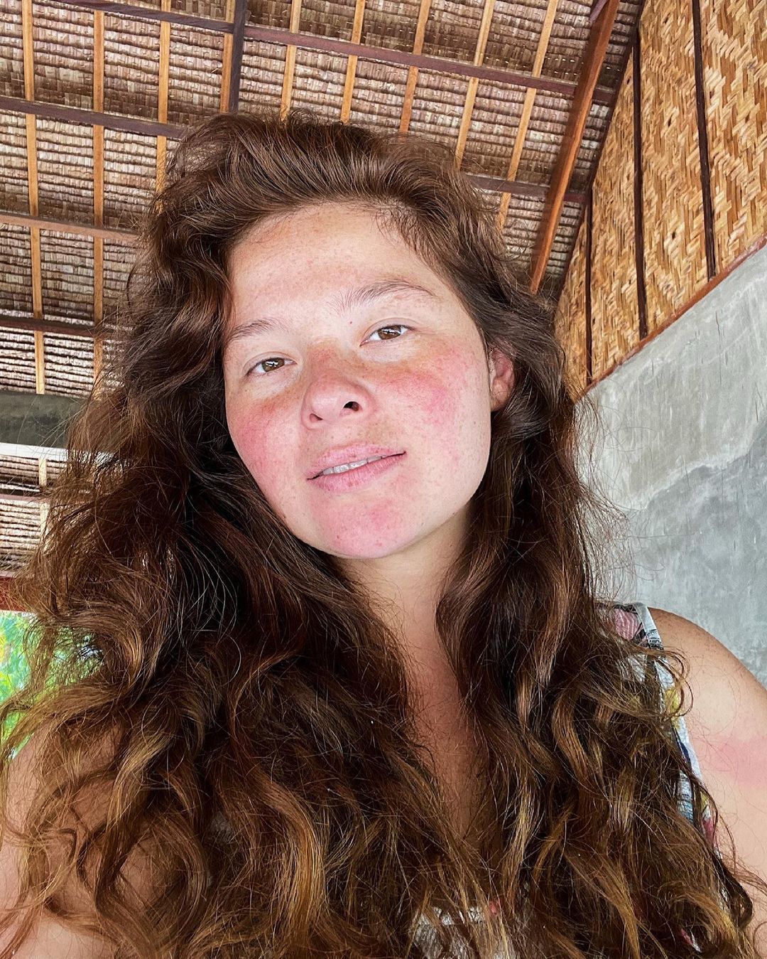 Actress, Andi Eigenmann, embraces and accepts her skin with love. (Credit: Instagram/andieigengirl)