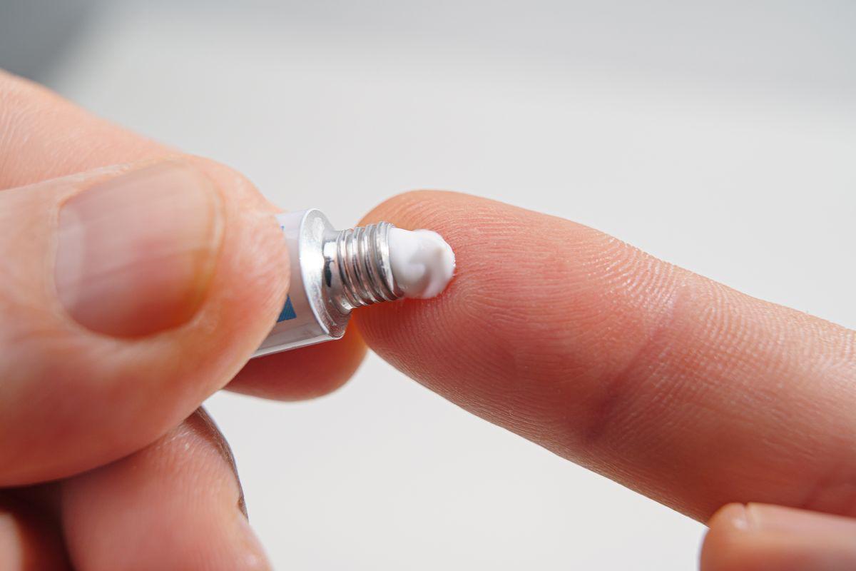 Squeezing acne ointment onto finger 
