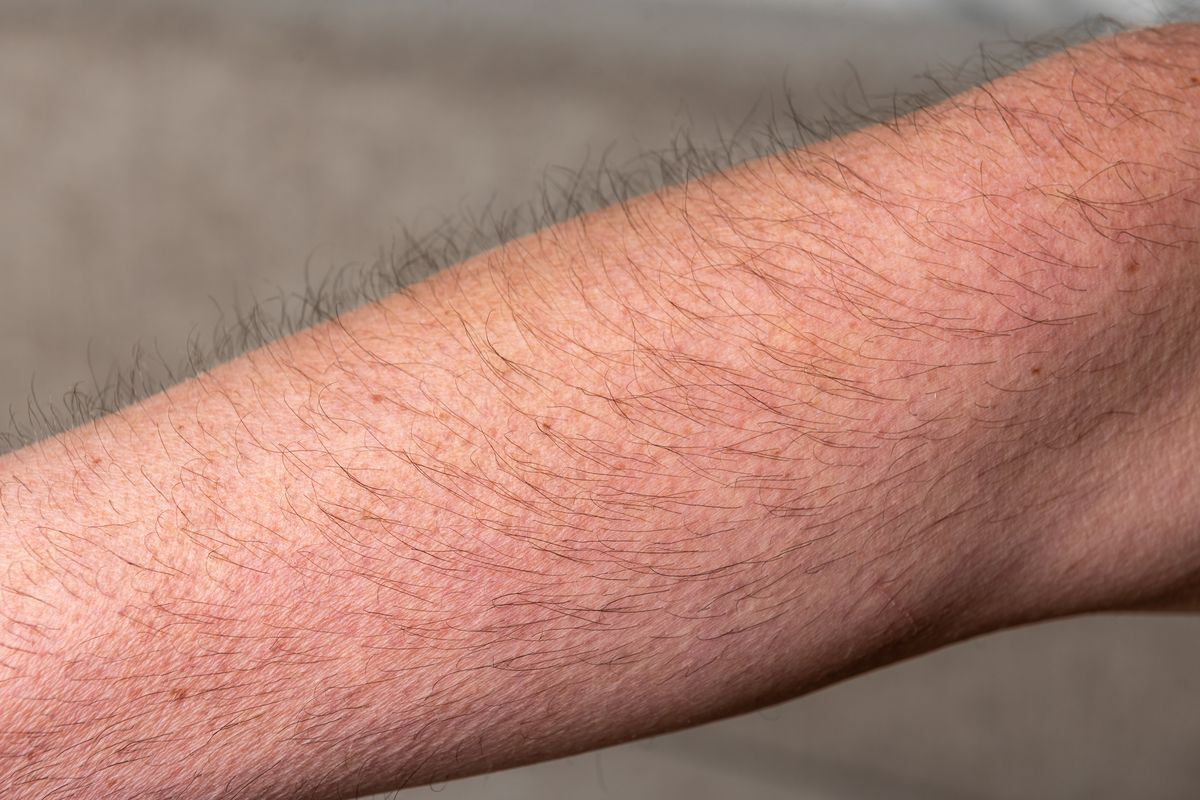 Man’s hairy arm; looks like it’s having goosebumps.