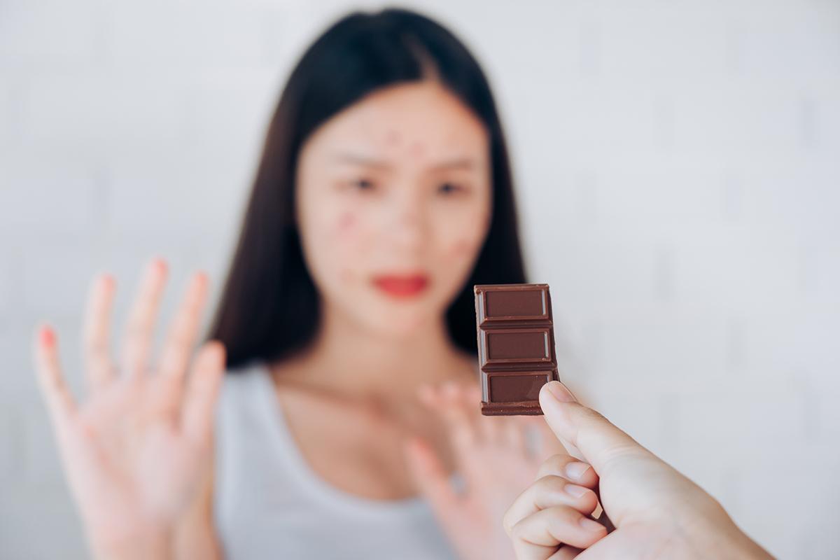 Asian woman with acne refusing chocolate