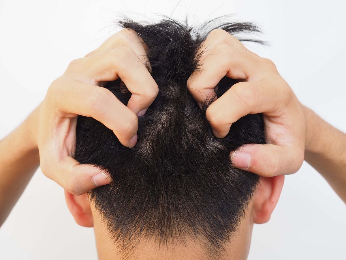 Back of an Asian man’s head pulling at hair 