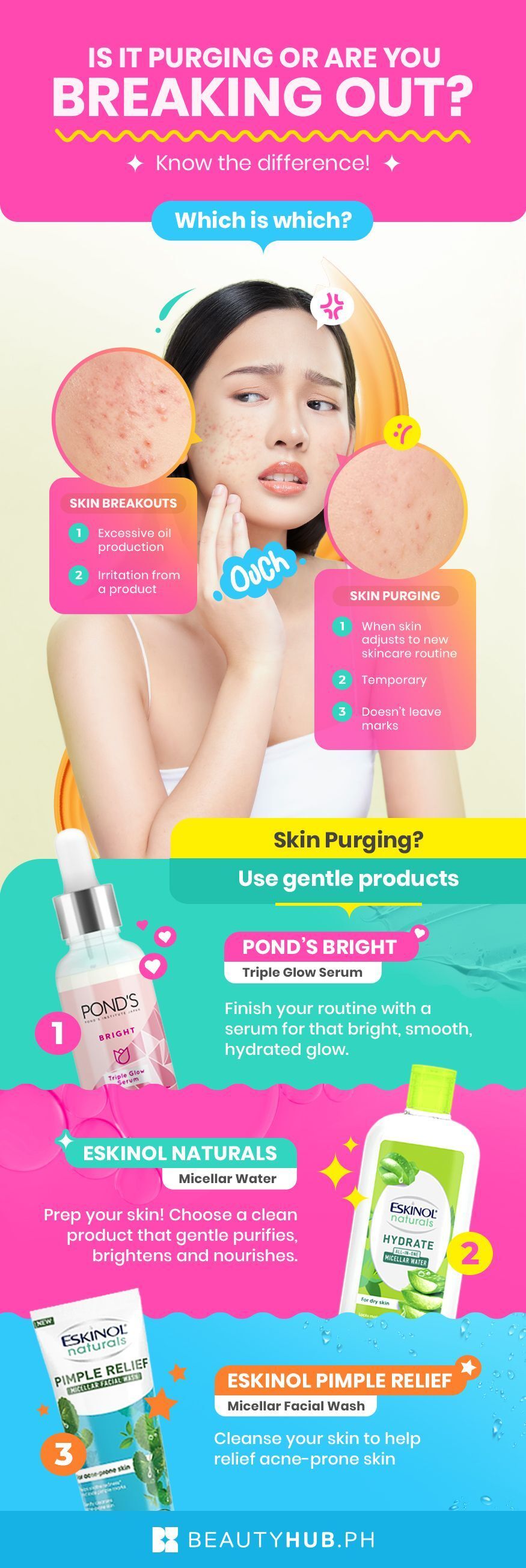 Infographic on skin purging