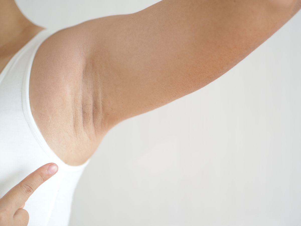 Closeup of a woman’s armpit 
