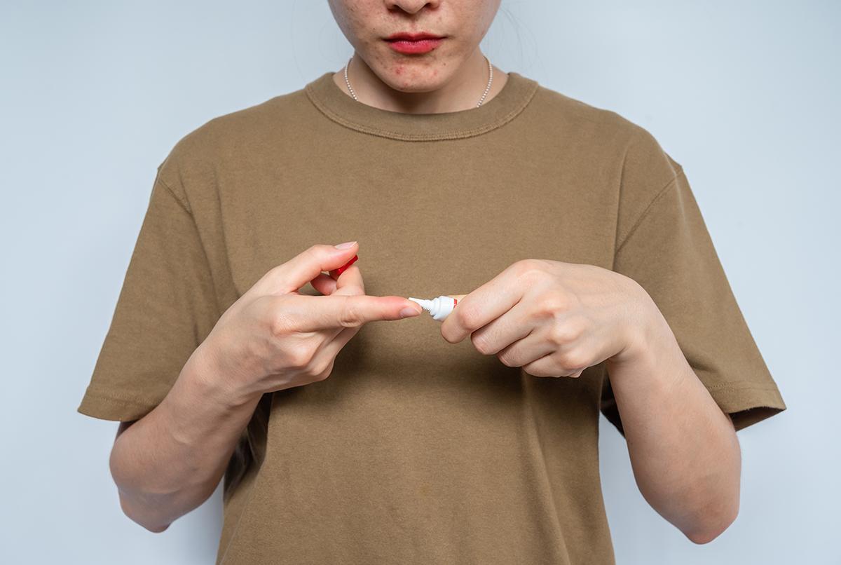Woman squeezes out acne cream from a tube