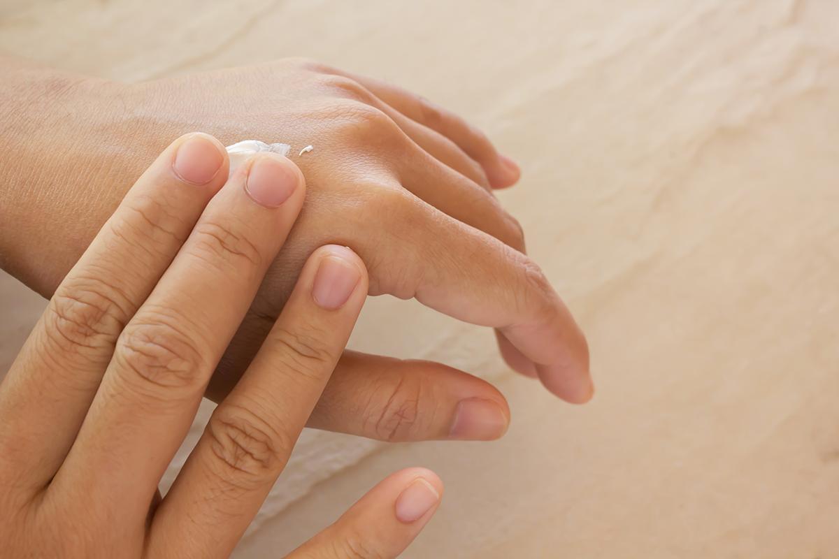 Woman with dry hands applying moisturizer