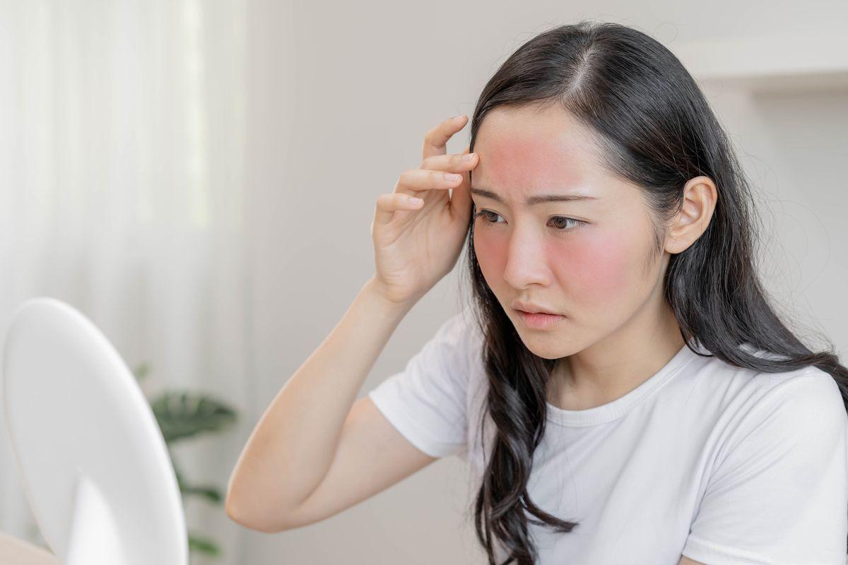 Young Asian woman with a red rash on forehead and cheeks looking in the mirror 