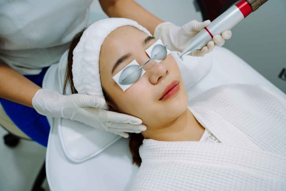 Laser Treatment for Acne Scars: Top Aftercare Tips