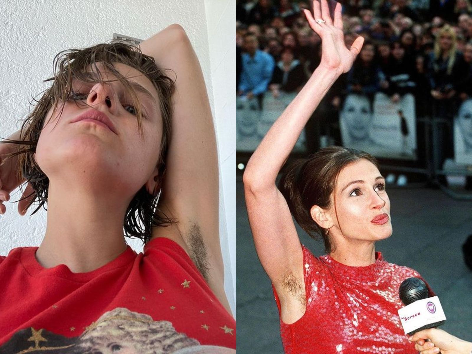 Celebrities Who Proved Hairy Armpits Can Be Empowering 