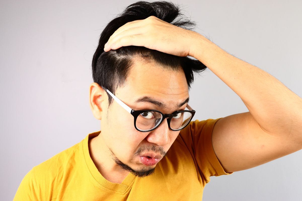 Asian man worried about his scalp.