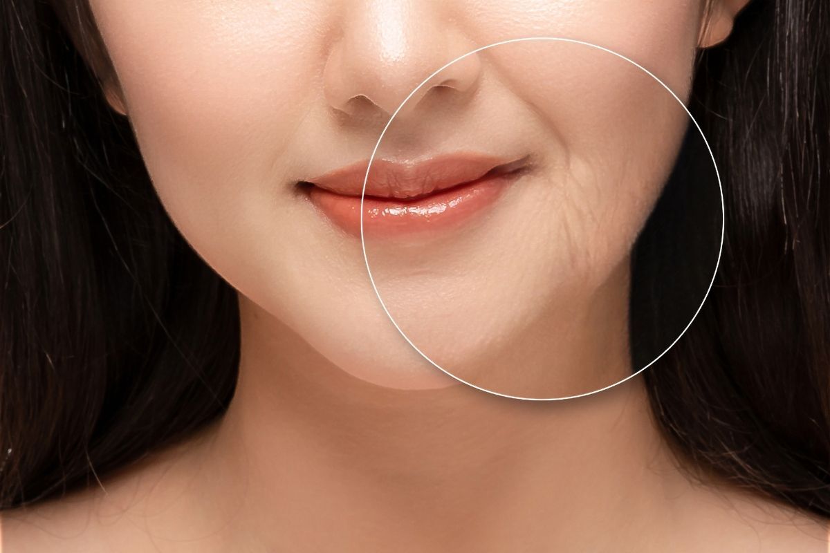 niacinamide có tác dụng chống lão hóa