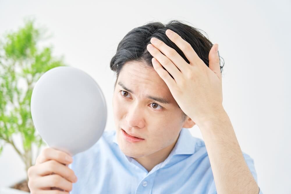 cách mọc tóc nhanh cho nam nguyên nhân tóc mọc chậm ở nam giới chàng trai soi gương với khuôn mặt lo lắng