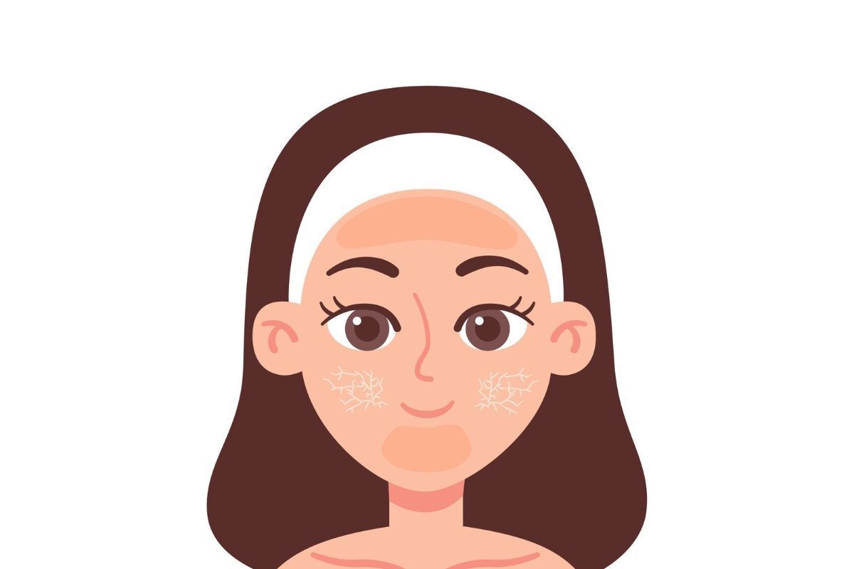 cách chăm sóc da hỗn hợp thiên khô