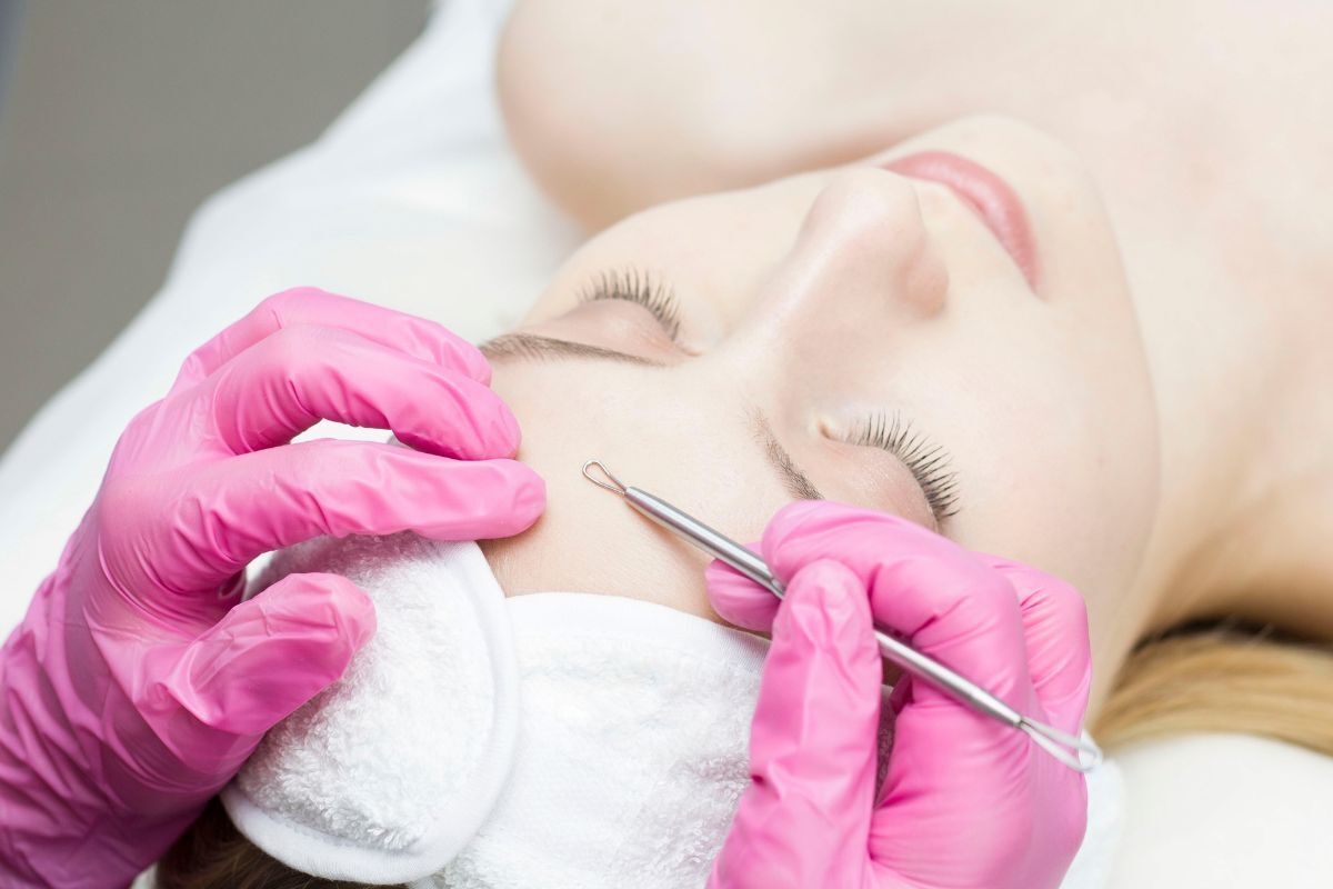 cách trị mụn ẩn dụng cụ nặn mụn đặt trên trán